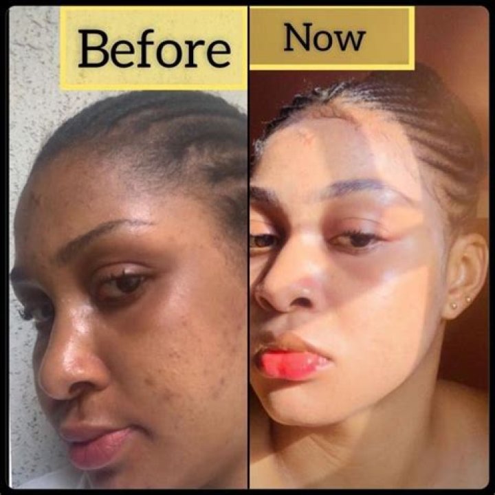 Celebrities And The Dangerous Allure Of Skin Bleaching