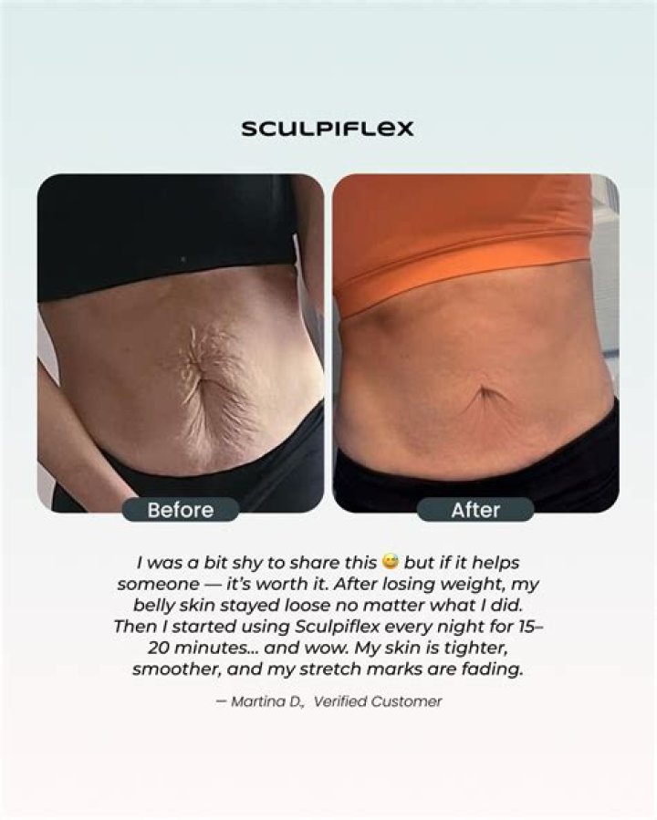 Comprehensive Sculpiflex Review: Does This Weight Loss Supplement Deliver Results?
