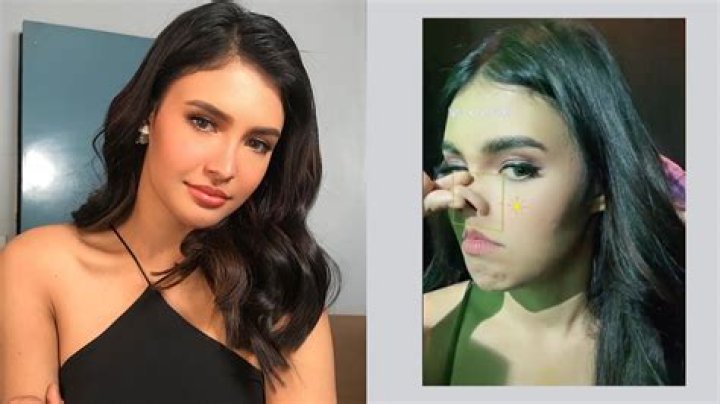 Dana Perino's Transformation: The Truth Behind The Nose Job Rumors