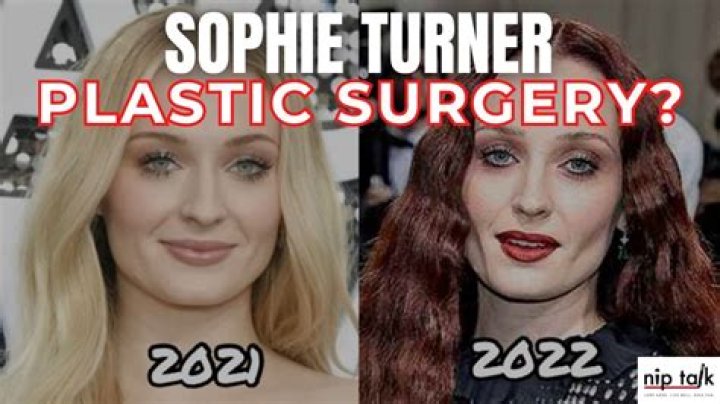 Did Sophie Rain Get Plastic Surgery? Exploring the Facts and Rumors