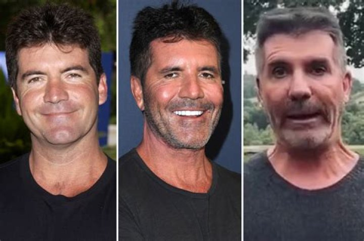 Does Simon Cowell's Son Have an Illness? Understanding His Health Journey