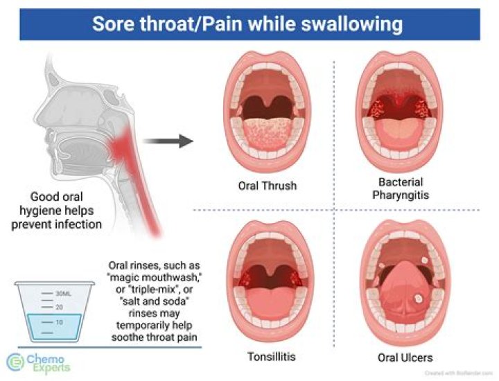Does Sprite Soothe Sore Throats?