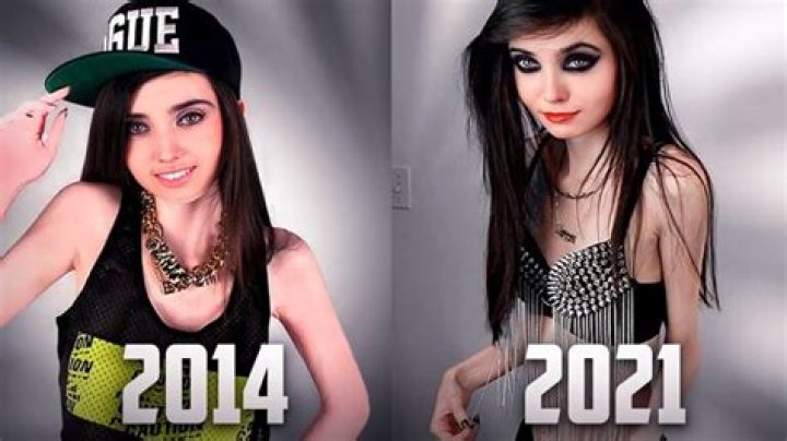 Eugenia Cooney: Before And After