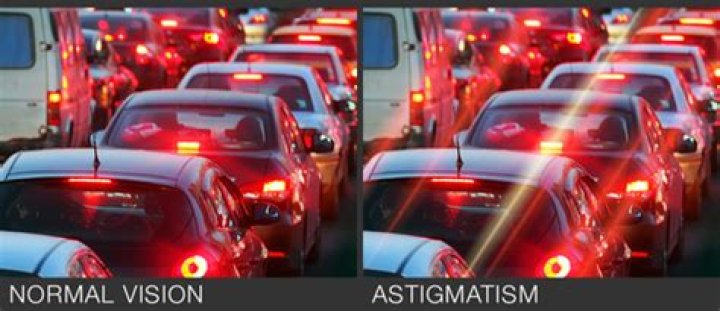 Expert Insights On Astigmatism And Driving