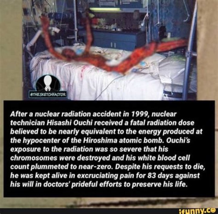 Exploring the Real Photos of Hisashi Ouchi: A Journey into the Life of a Nuclear Accident Survivor