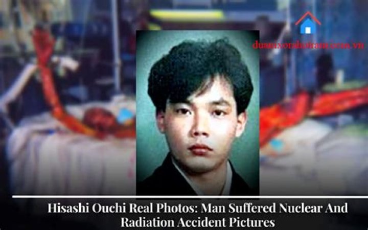 Exploring The Tragic Story Of Hisashi Ouchi And His Infamous Photo Body