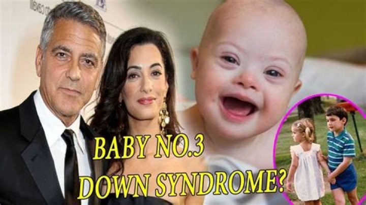 George Clooney's Son And Down Syndrome: A Heartfelt Journey