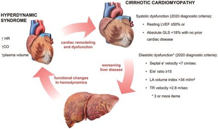 Heart Failure And Sonji Roi's Legacy