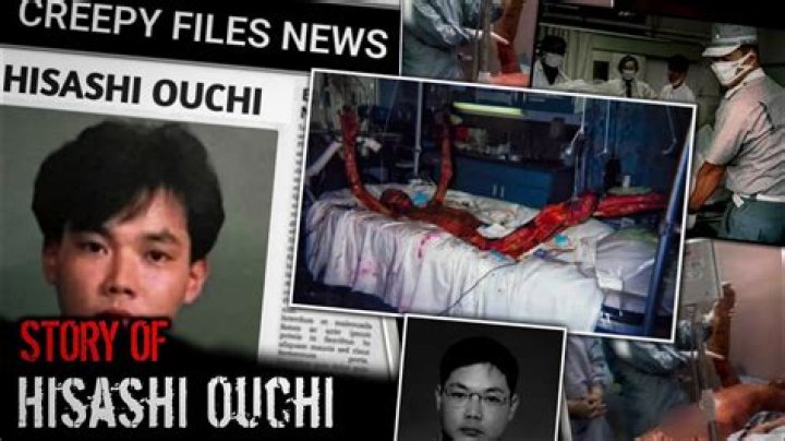 Hisashi Ouchi Real Photos: Unveiling the Tragic Story Behind the Images
