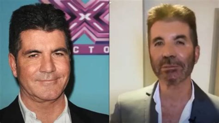 Is Simon Cowell Suffering From A Mysterious Illness?