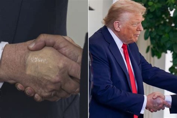 Is Trump Left Handed? Exploring the Truth Behind the Question