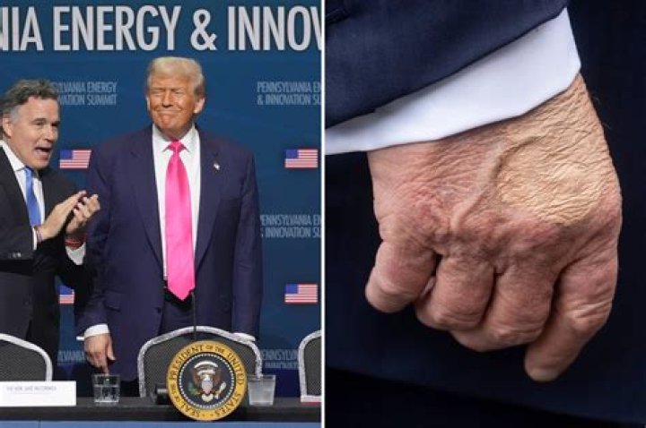 Is Trump Left or Right Handed? Unveiling the Truth Behind the Presidential Penmanship