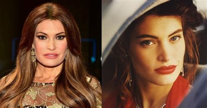 Kimberly Guilfoyle's Plastic Surgery Journey: A Comprehensive Overview