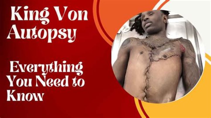 King Von's Autopsy: Uncovering The Tragic Details