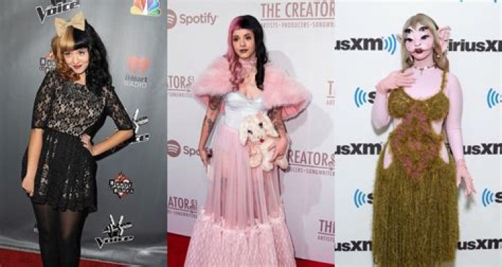 Melanie Martinez Plastic Surgery: Uncovering The Truth