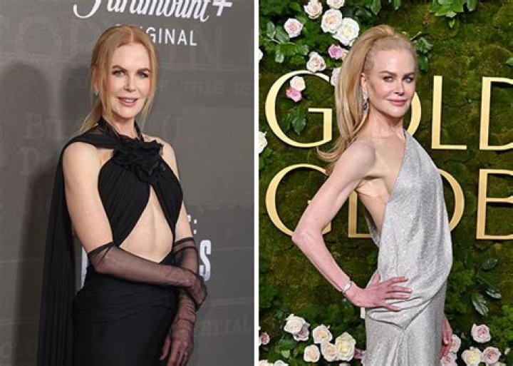 Transformations And Triumphs: The Journey Of Nicole Kidman’s Weight Loss