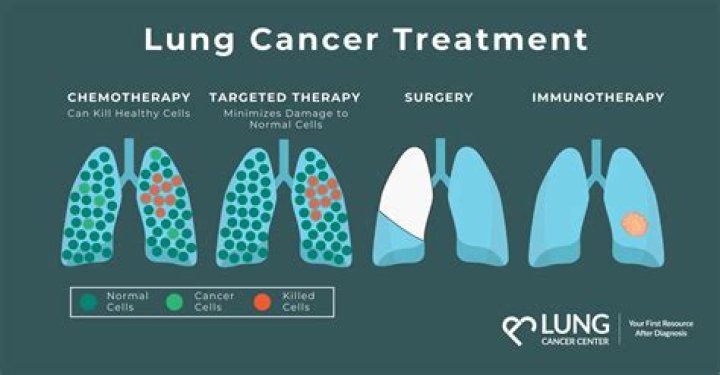 Uncovering Hope And Advancements In Lung Cancer
