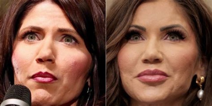 Uncovering The Truth: Did Kristi Noem Undergo Plastic Surgery?