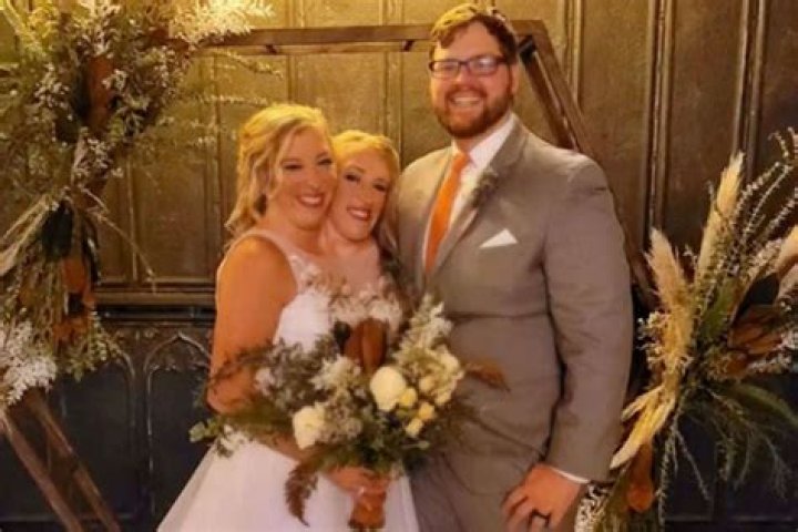Understanding the Cause of Death of Abby and Brittany Hensel: A Comprehensive Insight
