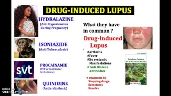 Understanding The Connection: Can Ozempic Cause Lupus?
