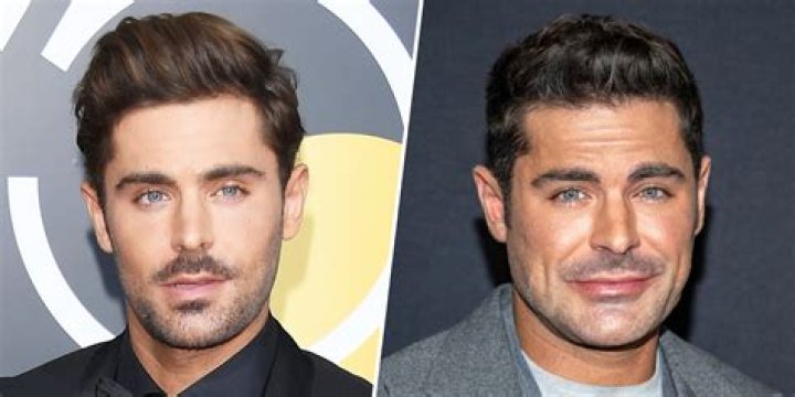 Unraveling The Mystery: What Happened To Zac Efron?
