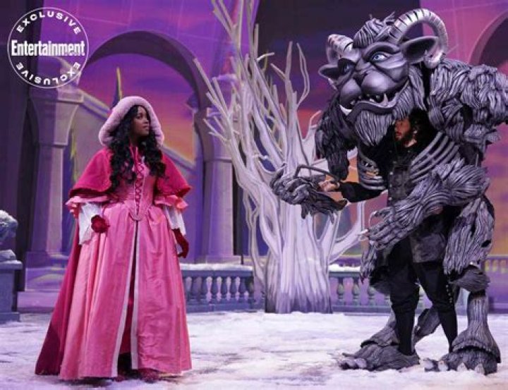 Unveiling The Beauty And Strength: Julie Gonzalo's Facial Scar