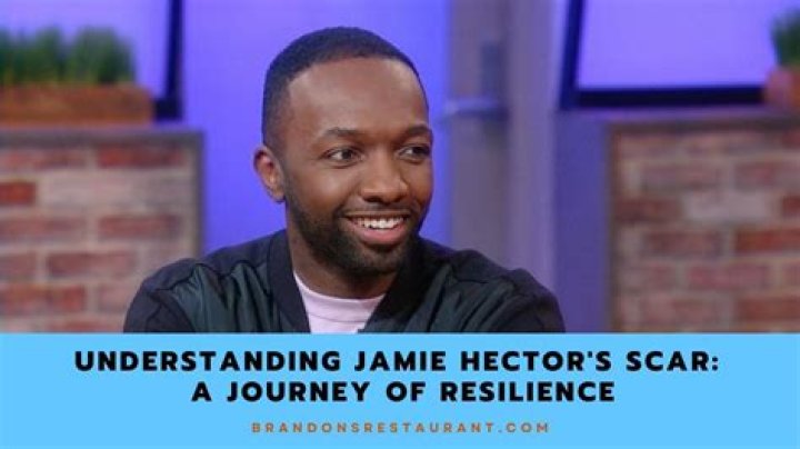 Unveiling The Power And Impact Of Jamie Hector's Facial Scar