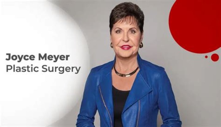Unveiling The Truth Behind Joyce Meyer's Plastic Surgery: A Closer Look