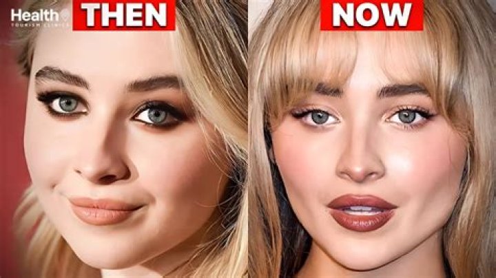 Unveiling The Truth: How Much Plastic Surgery Has Sabrina Carpenter Had?