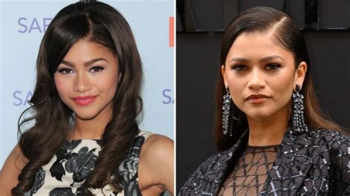 Unveiling Zendaya's Plastic Surgery: Discoveries And Insights