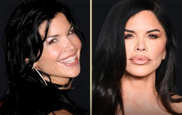 Vanessa Ferlito's Plastic Surgery Journey: Uncovering The Transformation