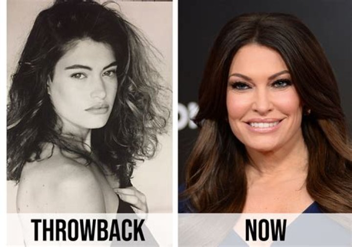 What Did Kimberly Guilfoyle Do to Her Face? A Deep Dive into Her Transformation